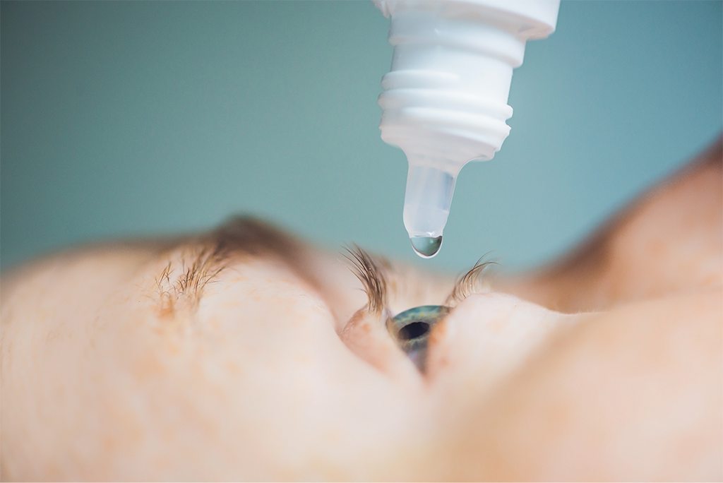 o que é o glaucoma